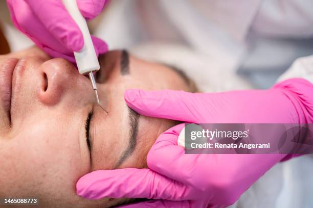 doctora realizando el rejuvenecimiento cosmético de la piel del paciente. blefaroplastia no quirúrgica con plasma. - eyelid fotografías e imágenes de stock