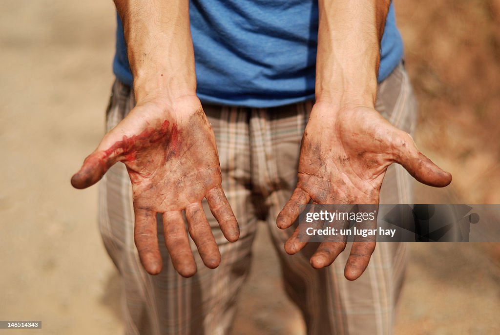 Dirty hands