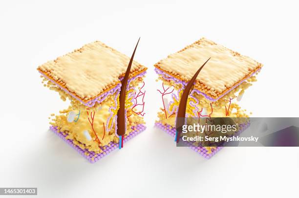 abstract microscope model of hair cuticle growth inside skin with sebaceous gland. hair transplantation under the microscope. - blackheads stock pictures, royalty-free photos & images