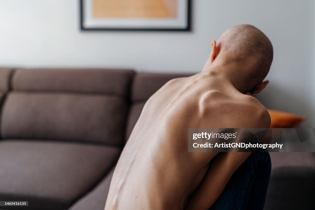 Woman suffering with cancer and annorexian at home.
