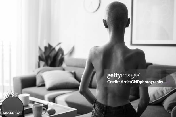 foto negra y de mierda de una mujer joven luchando contra el cáncer y la anorexia. - trastorno de alimentación fotografías e imágenes de stock