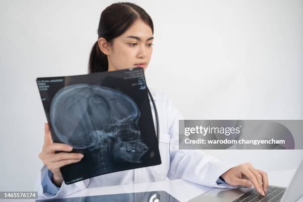 female doctor looking at x-ray film with computer. - röntgenaufnahme stock-fotos und bilder