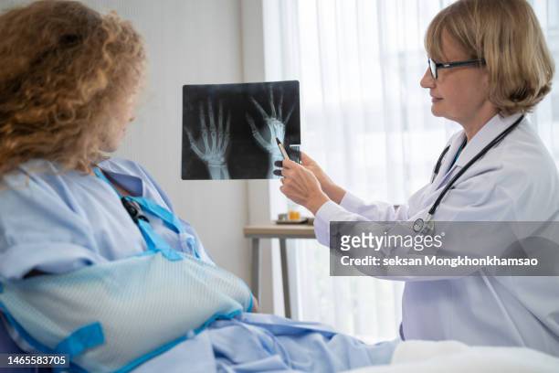 female doctors and patient look at the film x-ray of hand to examination in hospital. - medical x ray ストックフォトと画像