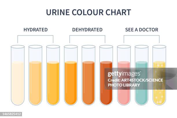 Urin Color Matrix Urine Colour Chart Illustration High-Res Vector Graphic - Getty Images