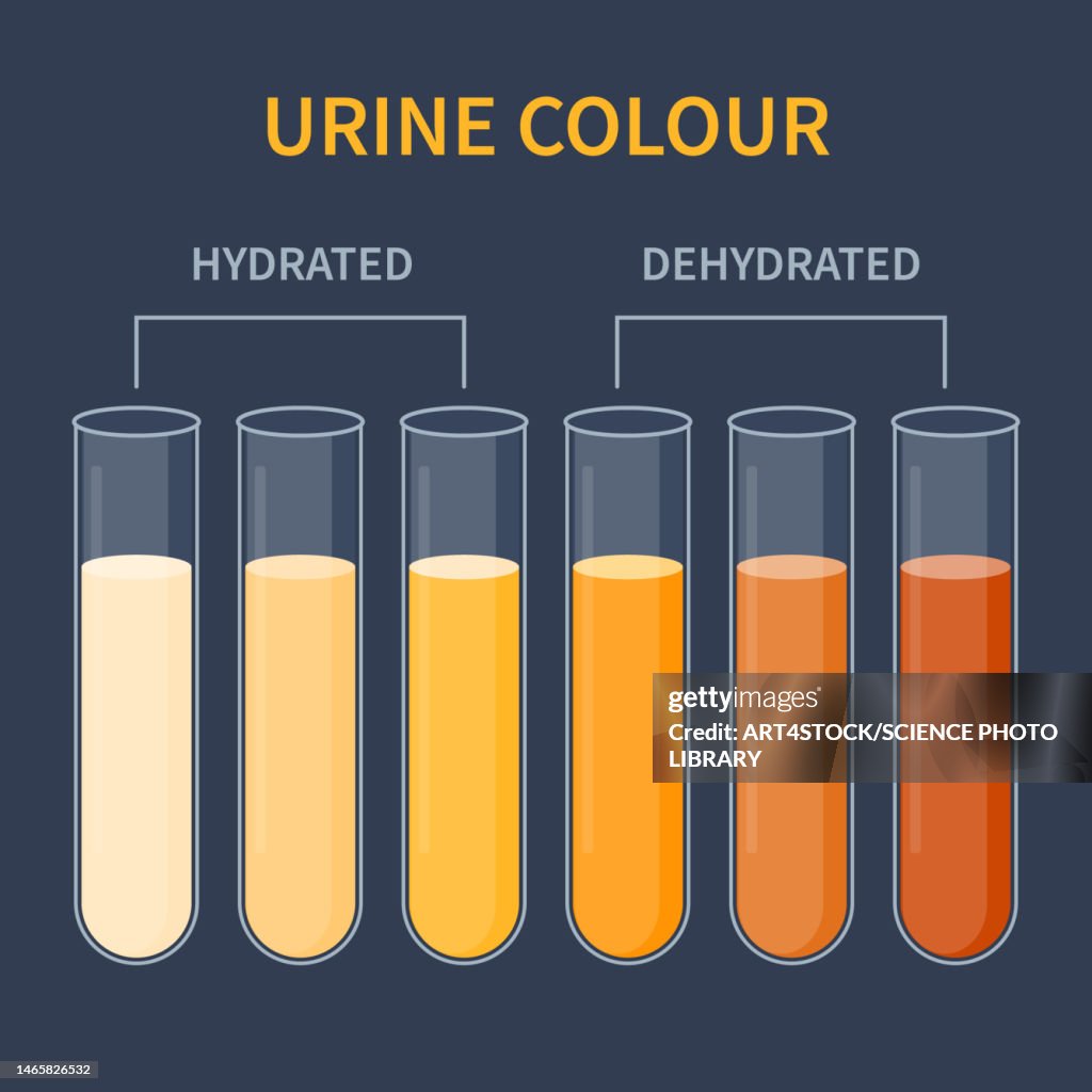 Urien Colou Rscale Urine Colour Chart Illustration High-Res Vector Graphic - Getty Images