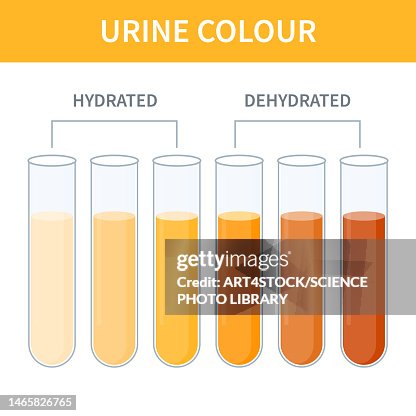 Urien Colou Rscale Urine Colour Chart Illustration High-Res Vector Graphic - Getty Images