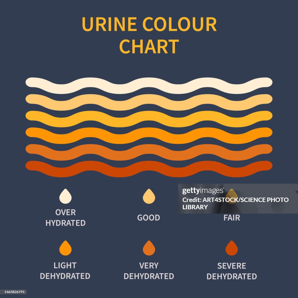 Urine colour chart, illustration