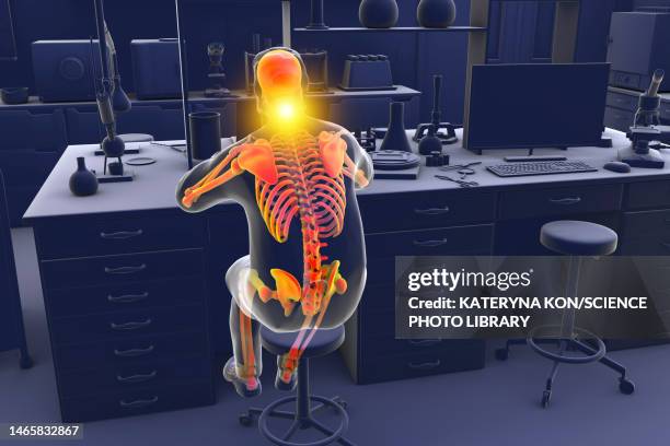 musculoskeletal disorders in lab workers, illustration - lower back pain concept stock illustrations