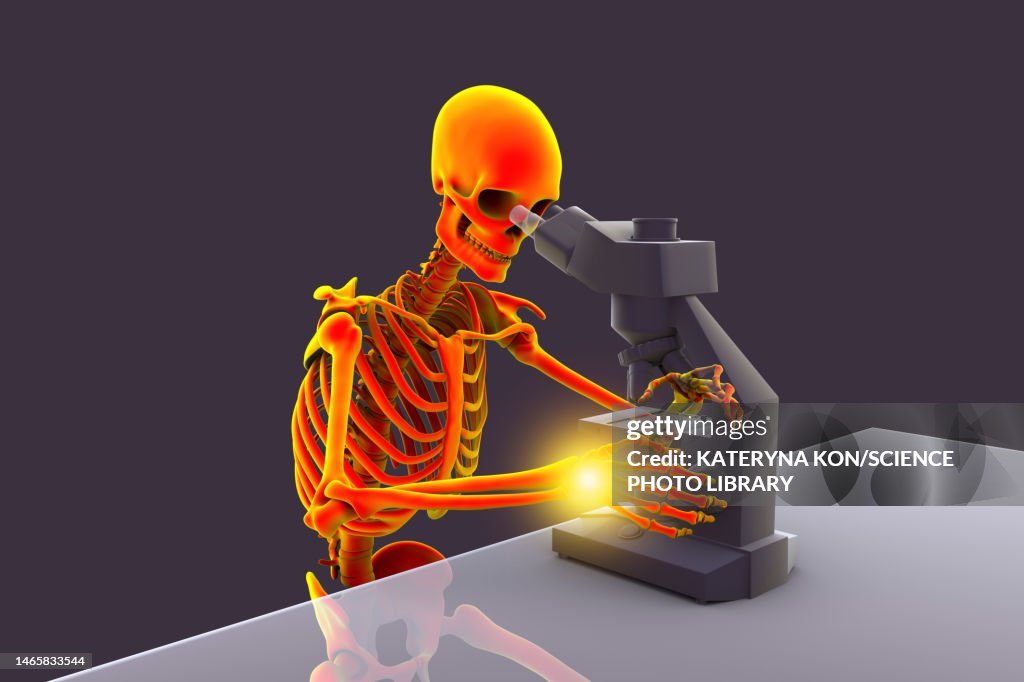 Carpal tunnel syndrome in laboratory workers, illustration
