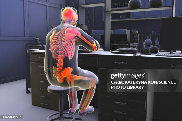 musculoskeletal disorders in lab workers, illustration - lower back pain stock illustrations