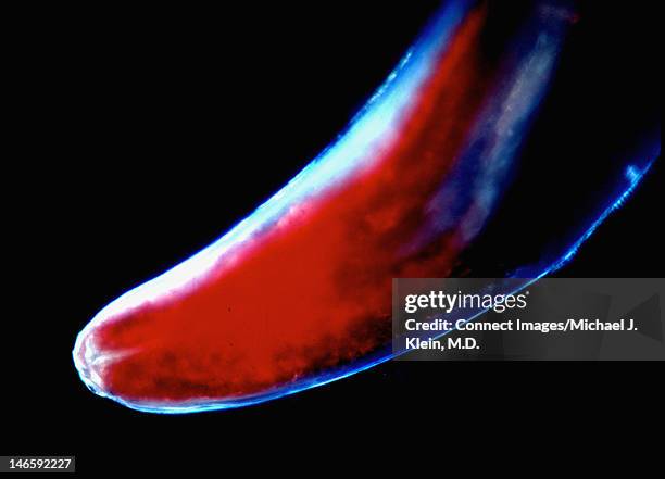 anisakis simplex adult worms - anisakis stock pictures, royalty-free photos & images