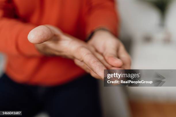 unrecognizable man massaging his hand - hand rubbing stockfoto's en -beelden