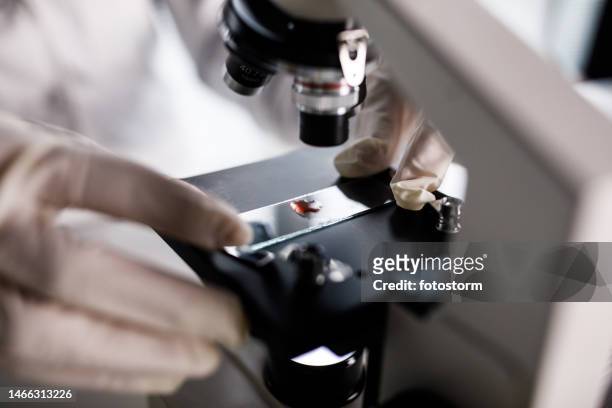 scientist analyzing red liquid or blood under a microscope - slide stockfoto's en -beelden