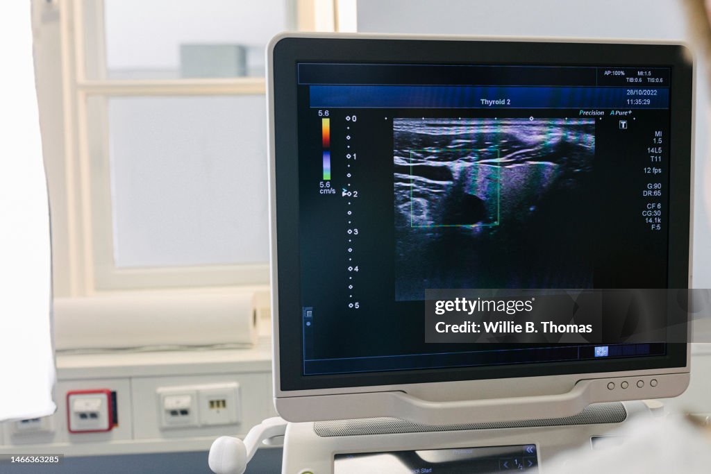 Thyroid ultrasound