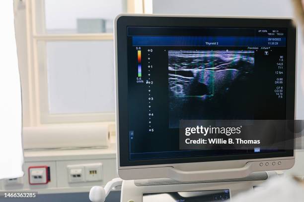 thyroid ultrasound - ecografia foto e immagini stock