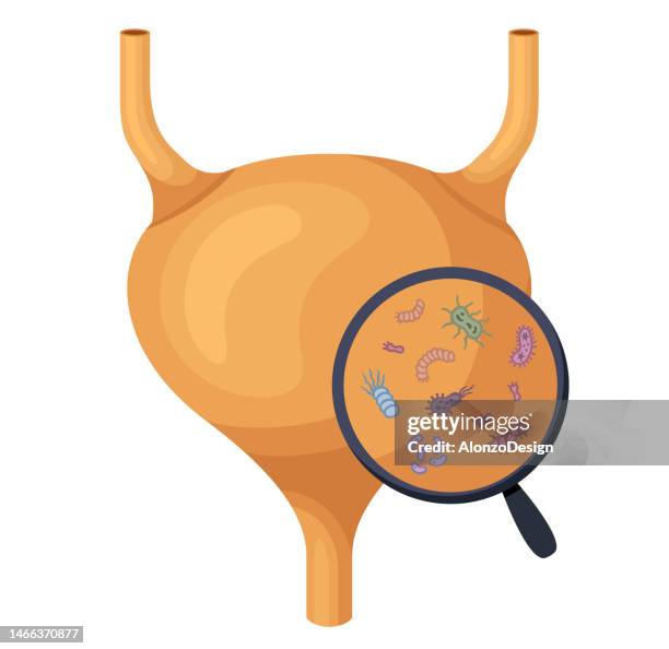 blase mit urin. infektion und entzündung des urins. viren und bakterien. bakterielle infektion. - physiology stock-grafiken, -clipart, -cartoons und -symbole