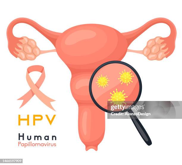 ilustraciones, imágenes clip art, dibujos animados e iconos de stock de concepto de salud de la mujer. virus del papiloma humano. causa cáncer cervical. la estructura de los órganos pélvicos. - vph