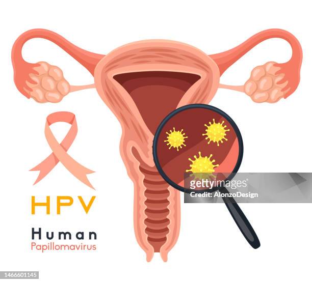 ilustraciones, imágenes clip art, dibujos animados e iconos de stock de concepto de salud de la mujer. virus del papiloma humano. causa cáncer cervical. la estructura de los órganos pélvicos. - cervix