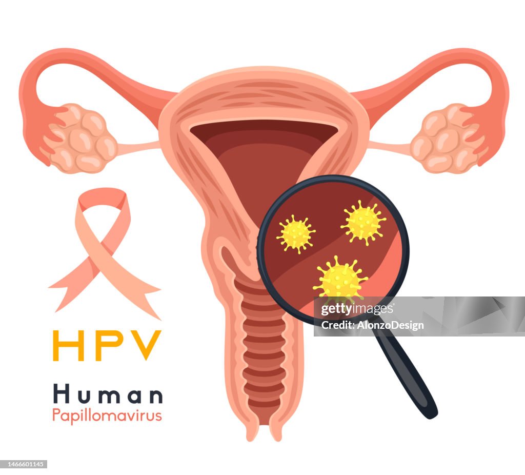 Women health concept. Human Papilloma Virus. Causes cervical cancer. The structure of the pelvic organs.