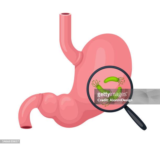 menschlicher magen und helicobacter pylori. - helicobacter pylori stock-grafiken, -clipart, -cartoons und -symbole
