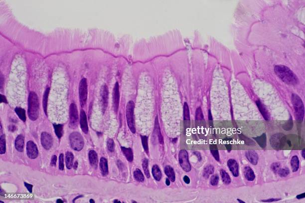 pseudostratified ciliated columnar epithelium - epitelio fotografías e imágenes de stock