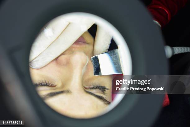 face skin treatment - dermatophyte - fotografias e filmes do acervo