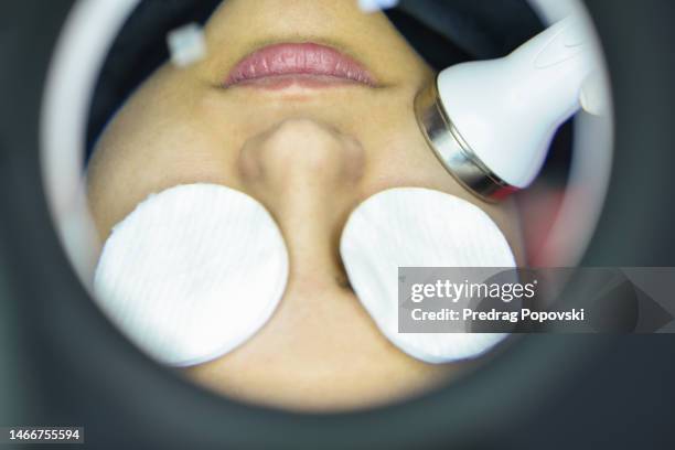 face skin treatment - dermatophyte - fotografias e filmes do acervo