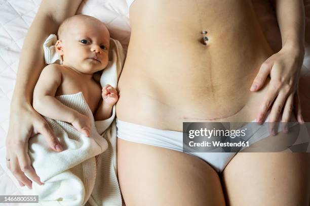 mother with caesarean scar lying by baby boy on bed - caesarean section stock-fotos und bilder