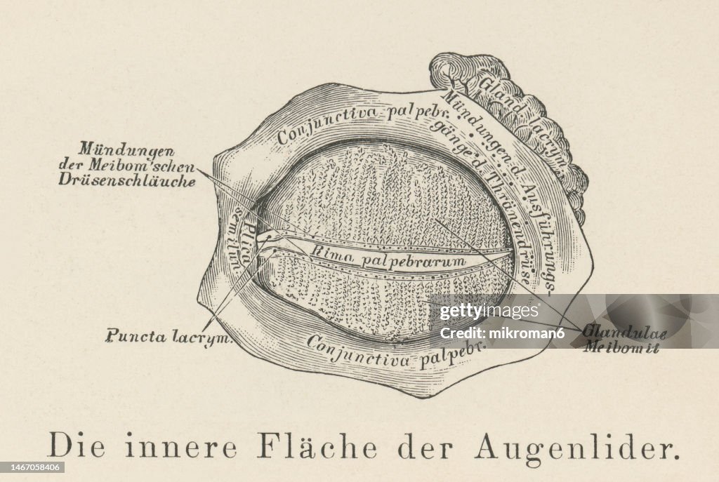 Old engraved illustration of eyelid anatomy - inner surface of the eyelid (Meibomian glands)