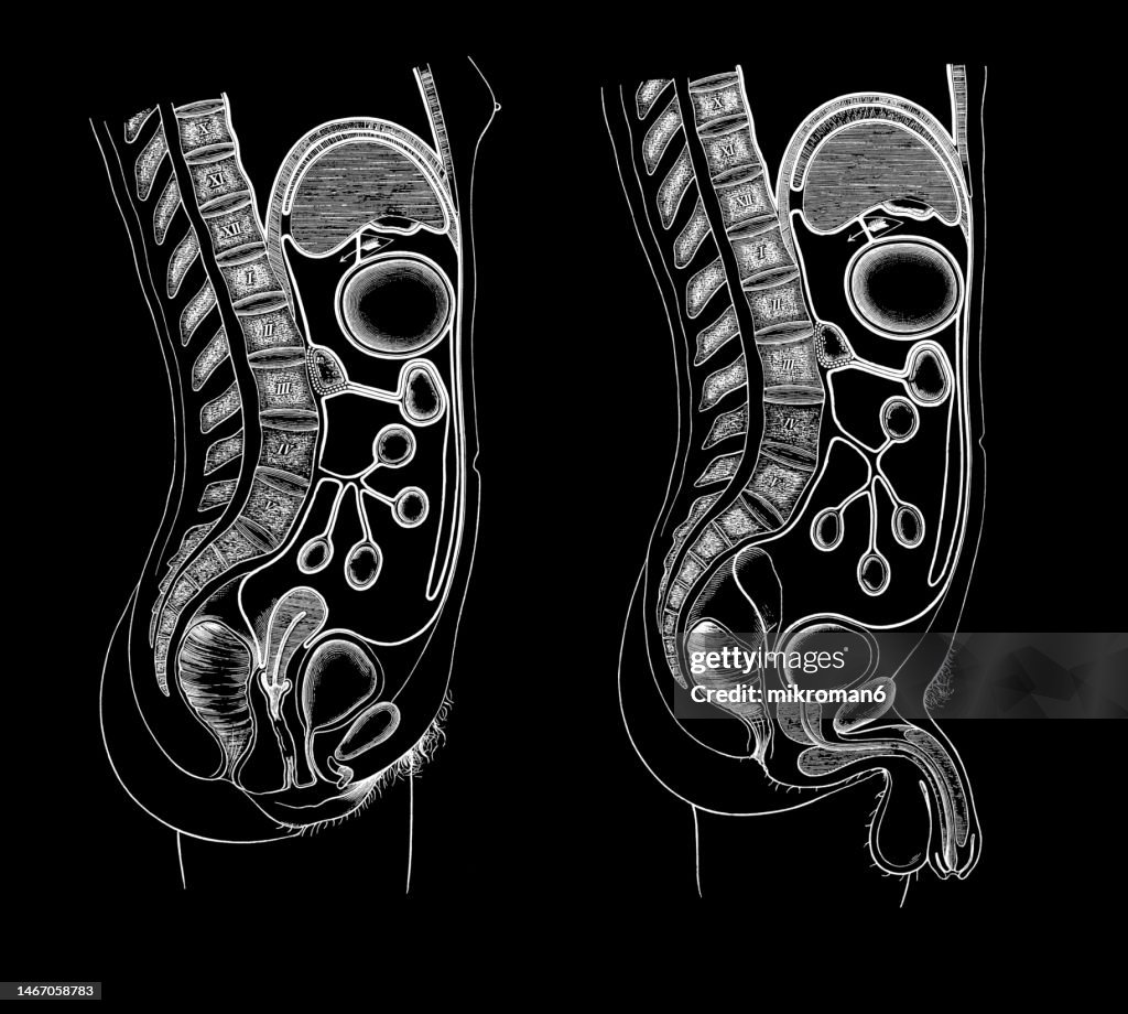 Old engraved illustration of the Human peritoneum (serous membrane forming the lining of the abdominal cavity or coelom)