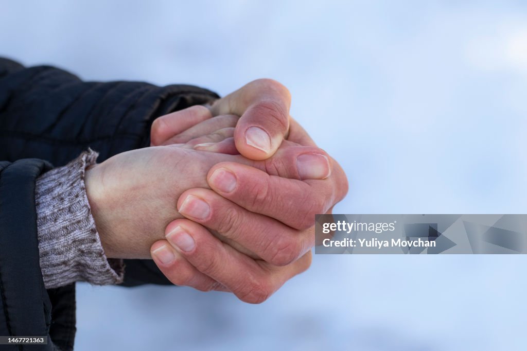 Mani rosse al freddo. Rischio di congelamento della mano o delle dita all'aperto durante la stagione fredda a causa del gelo in inverno.