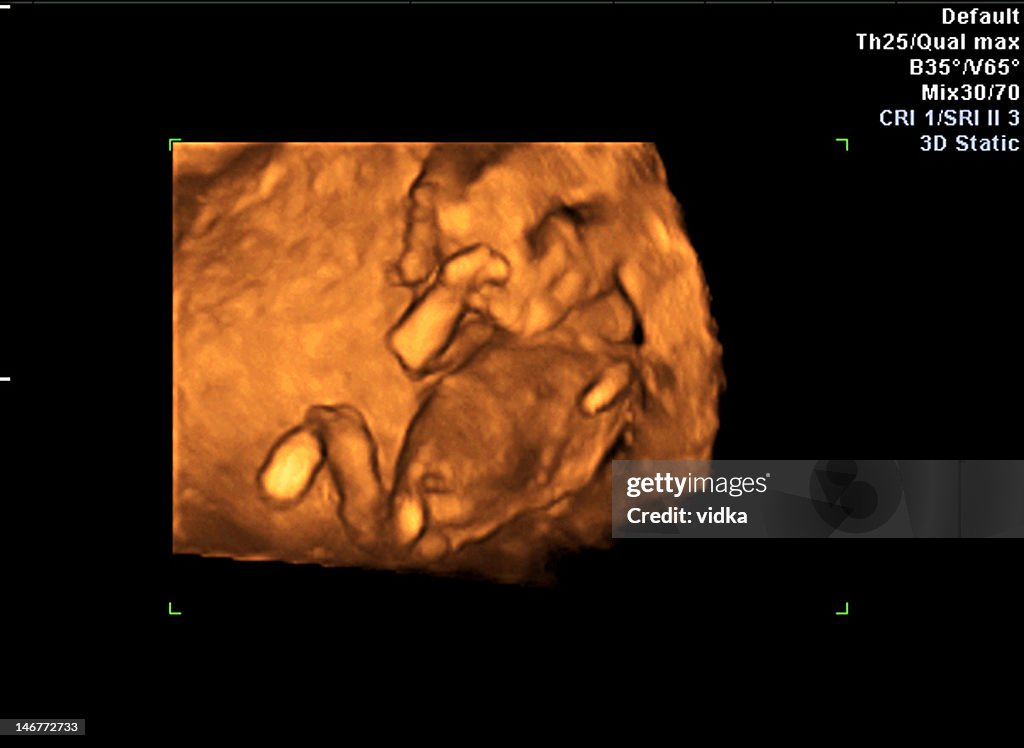 Menschliche Embryo. 3 Monate