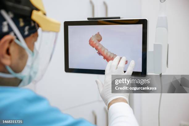 the dentist scans the patient's teeth with a 3d scanner. - digitalização 3d imagens e fotografias de stock
