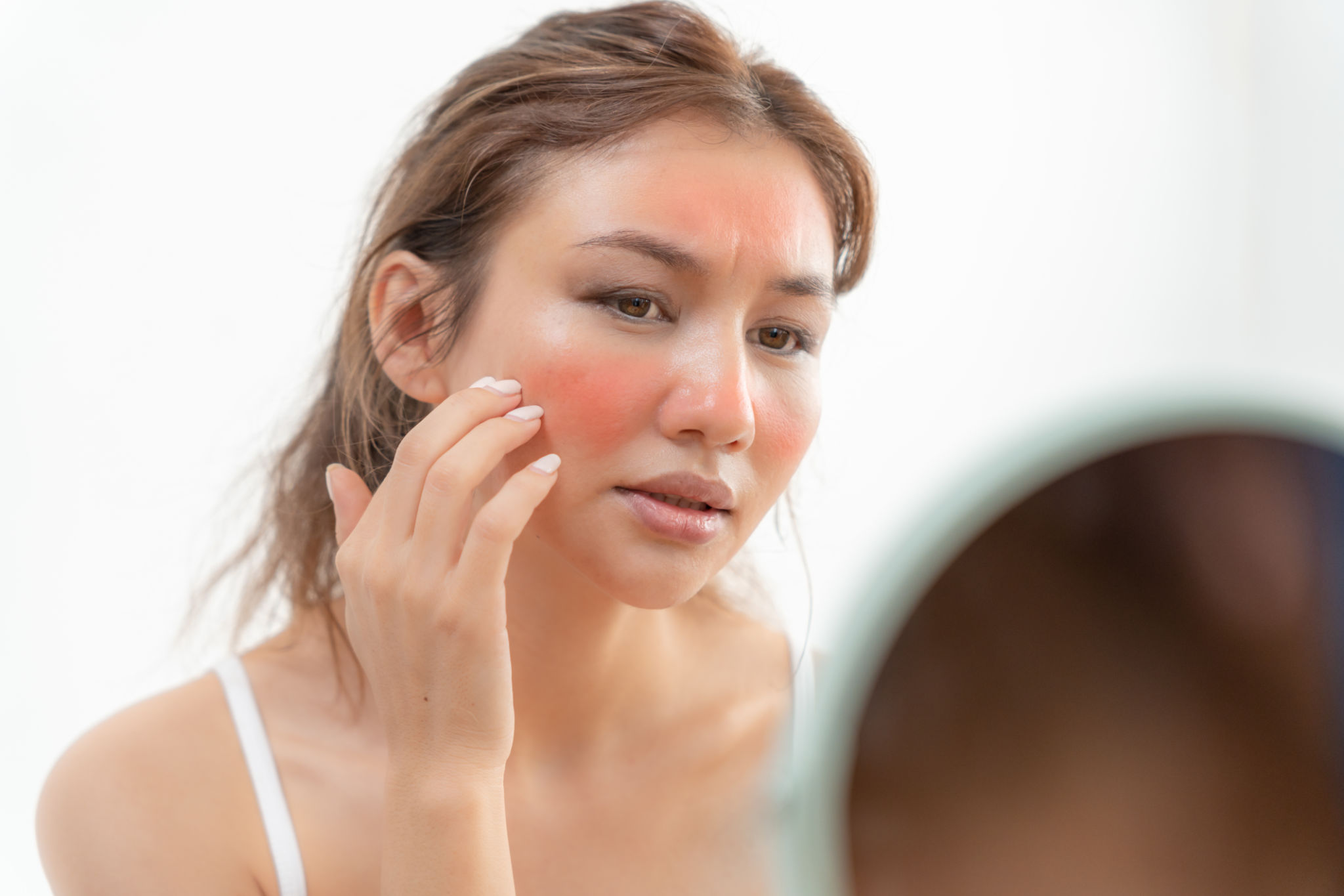 Young woman are worried about faces Dermatology and allergic to steroids in cosmetics. sensitive skin, red face from sunburn, acne, allergic to chemicals, rash on face. skin problems and beauty Young woman are worried about faces Dermatology and allergic to steroids in cosmetics. sensitive skin, red face from sunburn, acne, allergic to chemicals, rash on face. skin problems and beauty