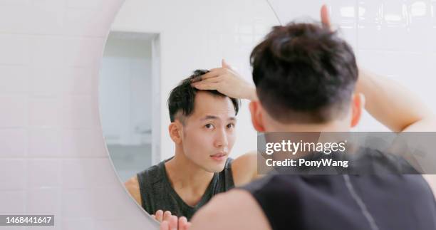 man worry about hair loss - receding hairline stock pictures, royalty-free photos & images