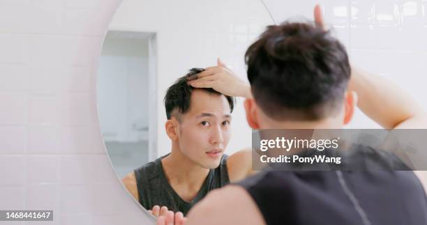 man worry about hair loss - receding stock pictures, royalty-free photos & images