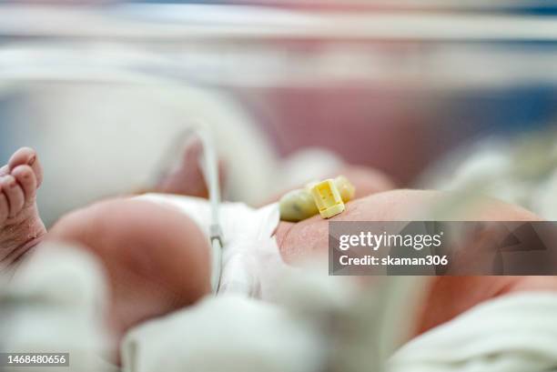 close up umbilical cord of newborn baby in the incubator the first day in the world - intensieve zorg stockfoto's en -beelden