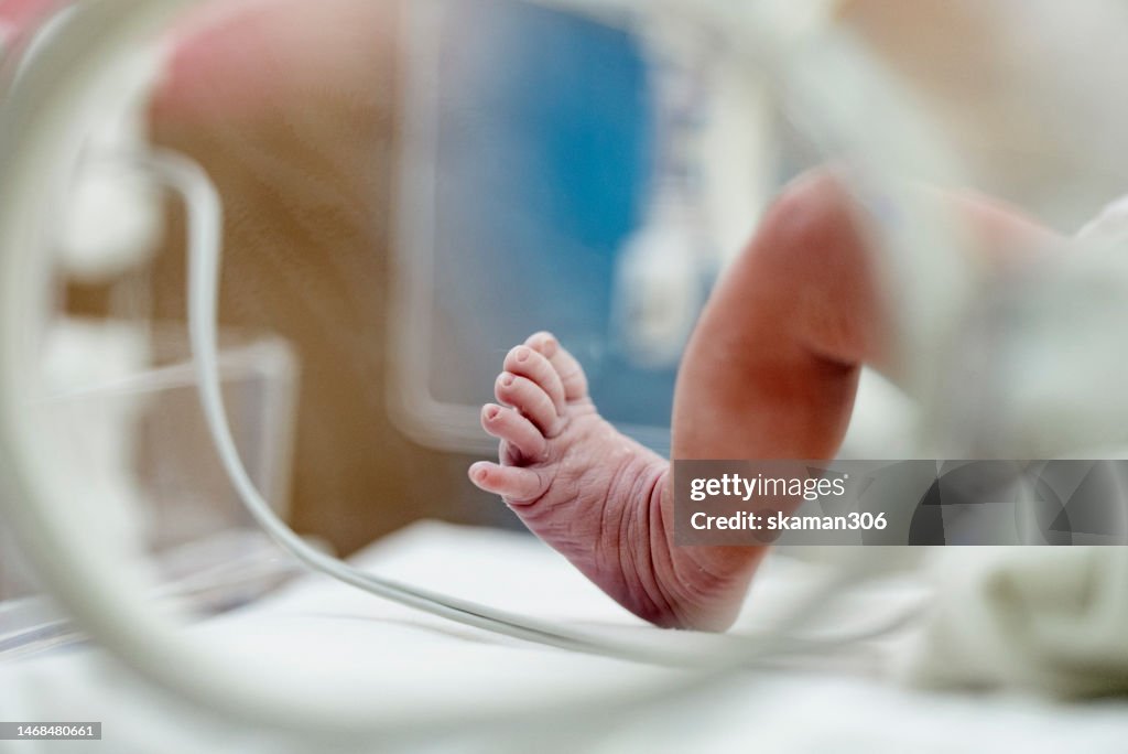 Selective focus Asian newborn foot with pulse sensor for monitor and moving in the incubator the first day in the world