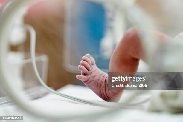 selective focus asian newborn foot with pulse sensor for monitor and moving in the incubator the first day in the world - new baby fotografías e imágenes de stock