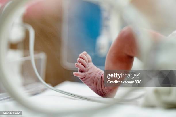 selective focus asian newborn foot with pulse sensor for monitor and moving in the incubator the first day in the world - premature 個照片及圖片檔