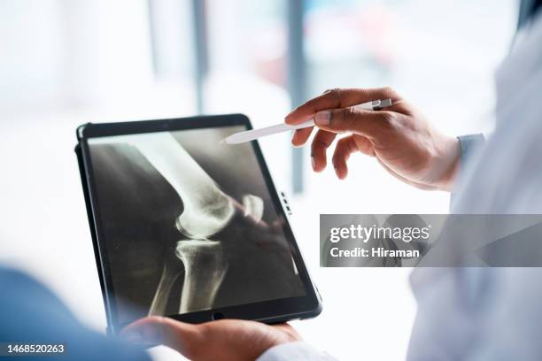hands, doctor and tablet with x ray in hospital for research, test results or exam in clinic. healthcare, radiology or male medical professional with touchscreen technology for mri, mammogram or xray - x ray image stock pictures, royalty-free photos & images