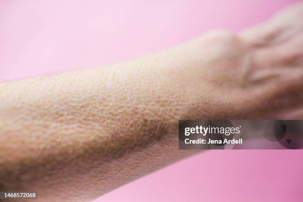 goosebumps, goose bumps on arm closeup - goosebumps stock pictures, royalty-free photos & images