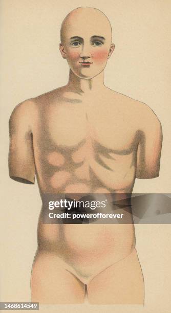 ilustrações de stock, clip art, desenhos animados e ícones de medical illustration of a human torso - 19th century - androgynous