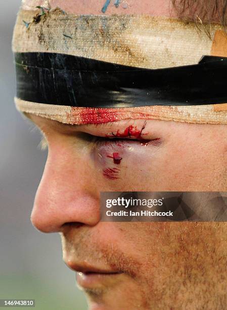 Luke MacDougall of the Bulldogs looks on after being injured during the round 16 NRL match between the Canterbury Bulldogs and the Melbourne Storm at...