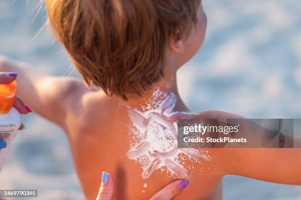 mom rubs sunscreen on the child's back. - sunburnt stock pictures, royalty-free photos & images