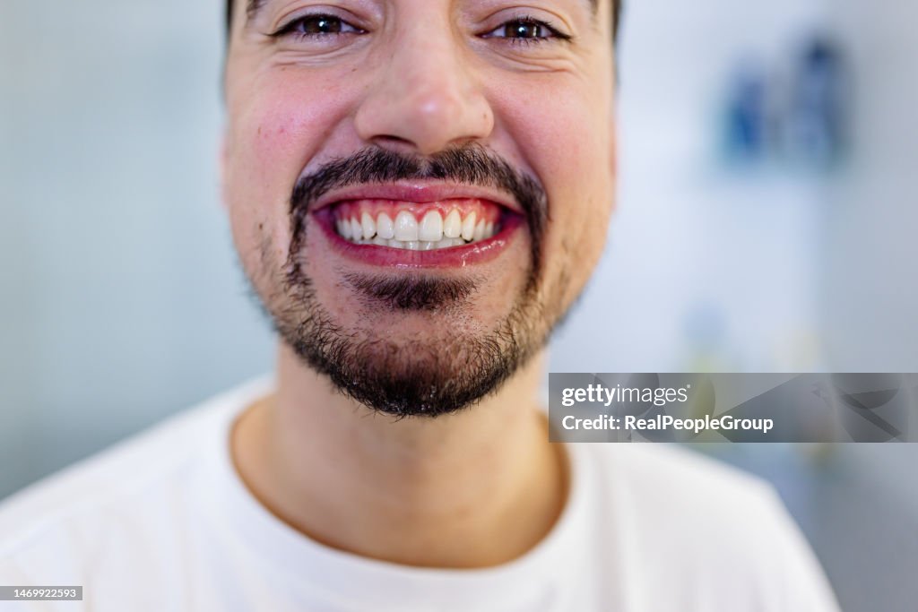 Igiene dentale