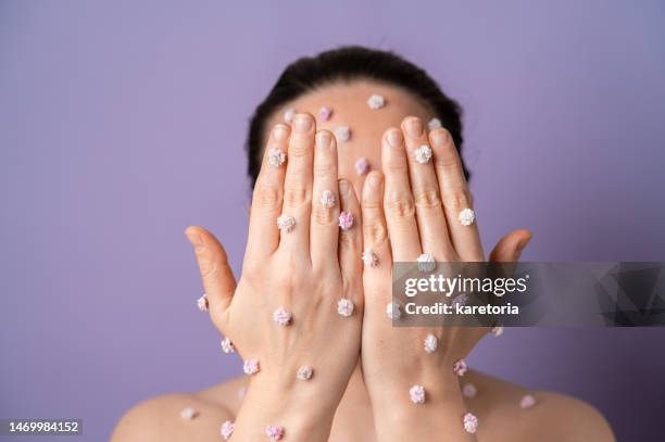 woman covering face with hands. small flowers on skin - irritation cutanée photos et images de collection