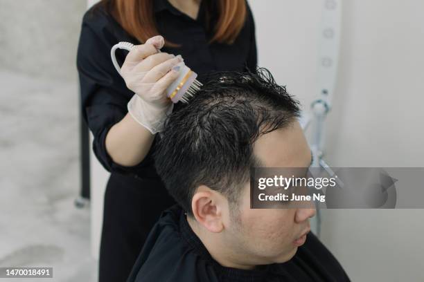soluciones modernas para la pérdida de cabello con tratamiento del cuero cabelludo. - cuero cabelludo fotografías e imágenes de stock