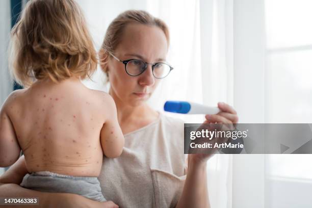 woman looks at pregnancy test and worries that her little girl has chickenpox during her pregnancy. concept of danger of infection during pregnancy. - chickenpox stock pictures, royalty-free photos & images