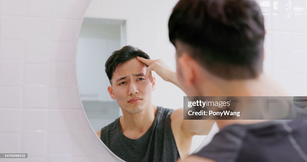 Mann sorgt sich um Haarausfall